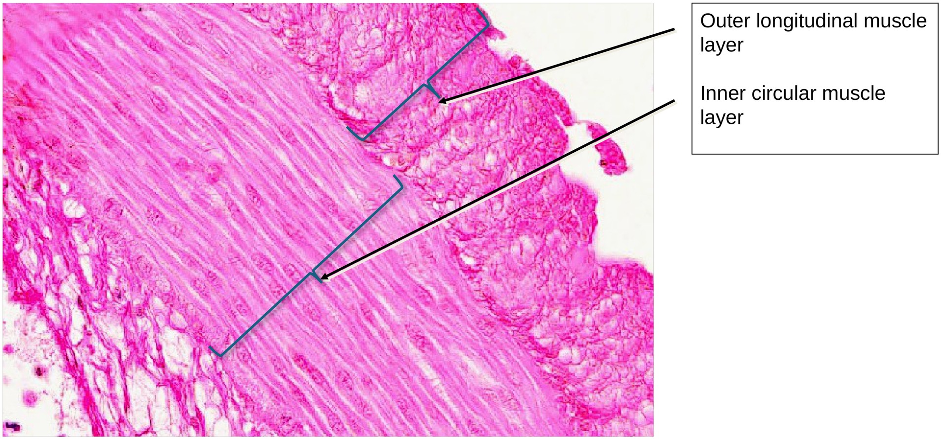 Ileum, Peyer’s patches