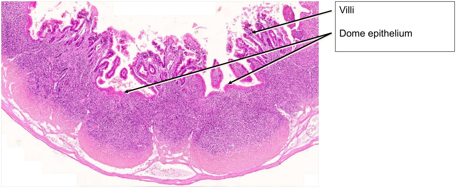 Ileum, Peyer’s patches