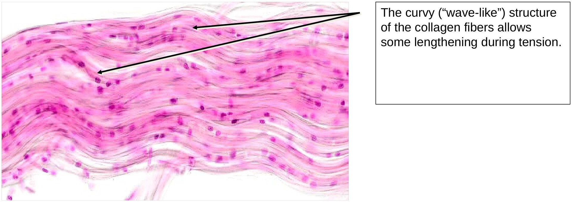 Collagen fibers (Tendon)