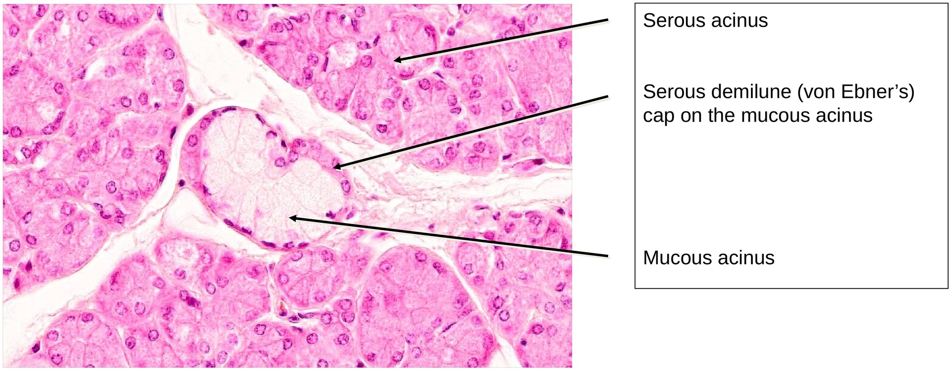 Submandibular gland