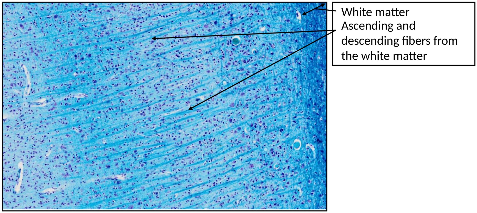 Cerebrum 3 (calcarine sulcus)