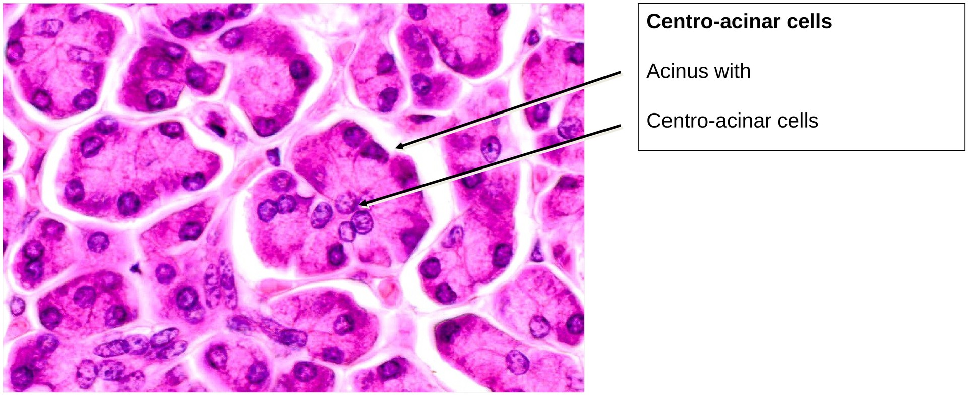 Pancreas, exocrine portion