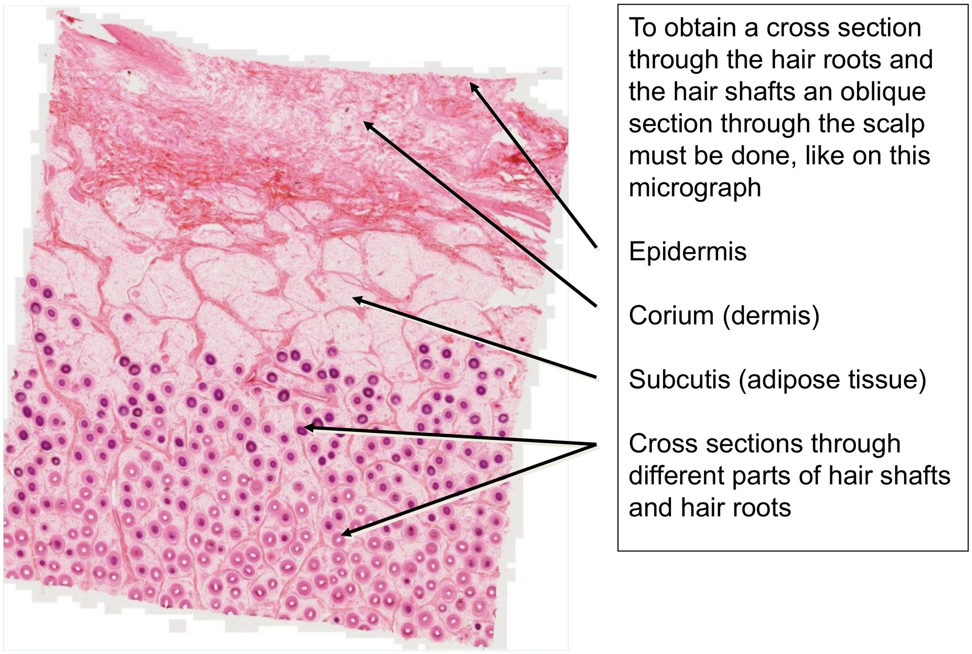 Scalp, cross