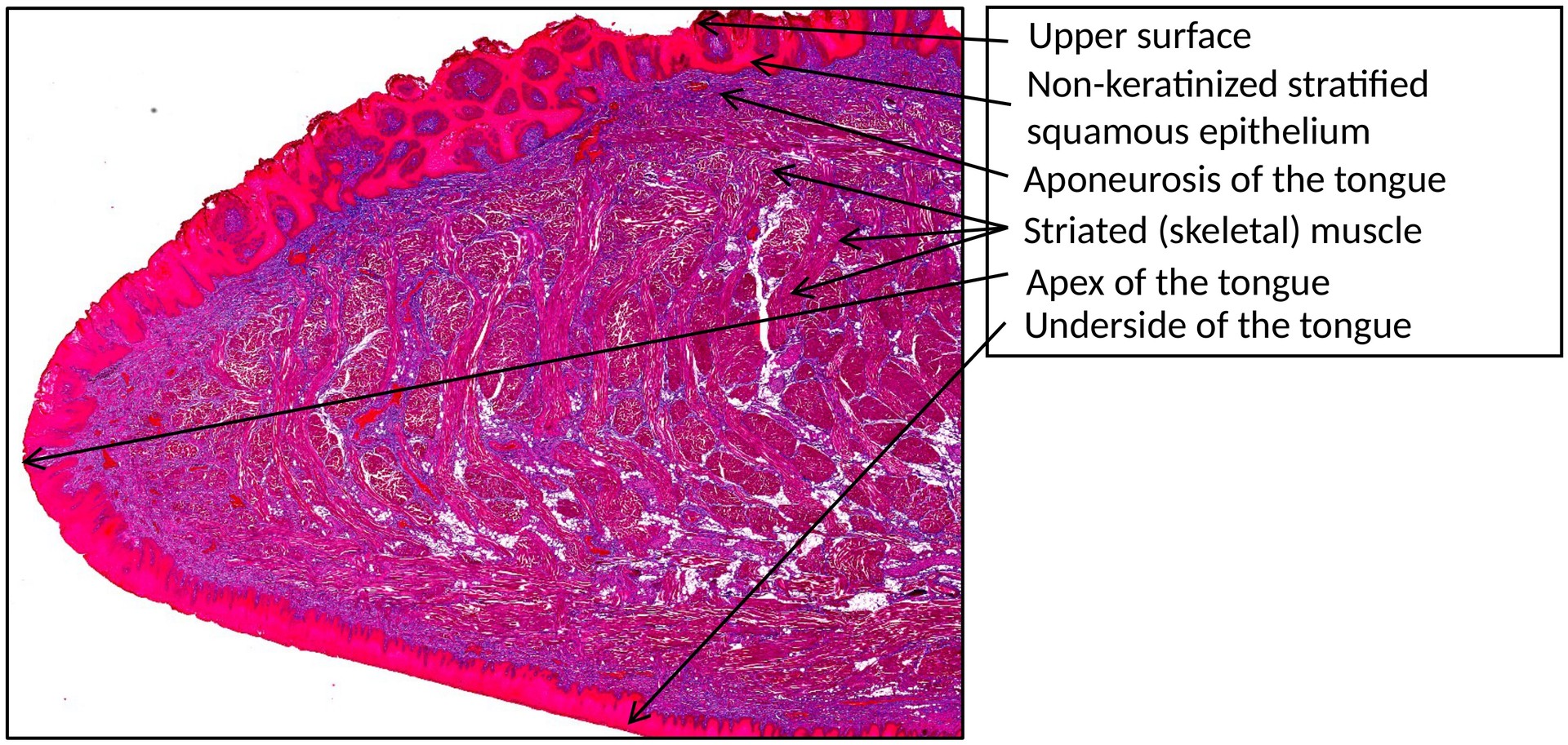 Tongue filiform papillae