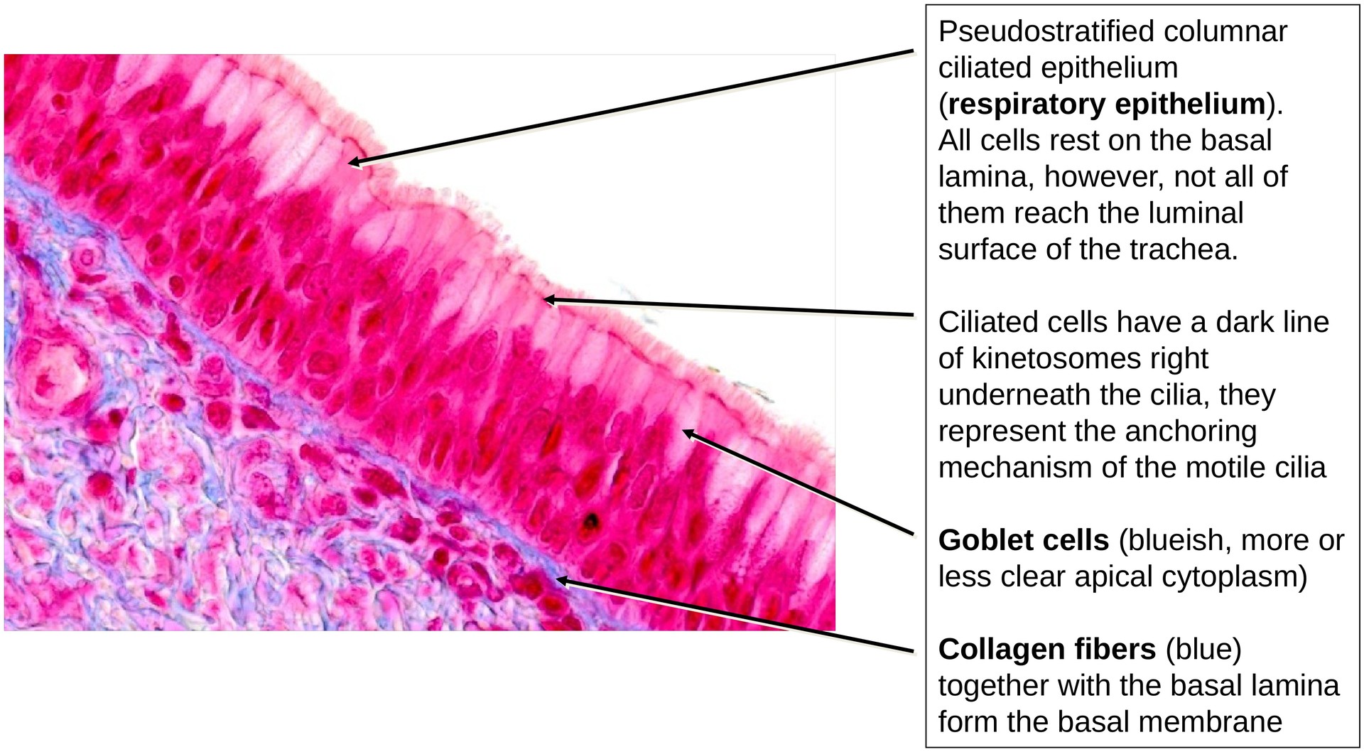 Respiratory epithelium (trachea)