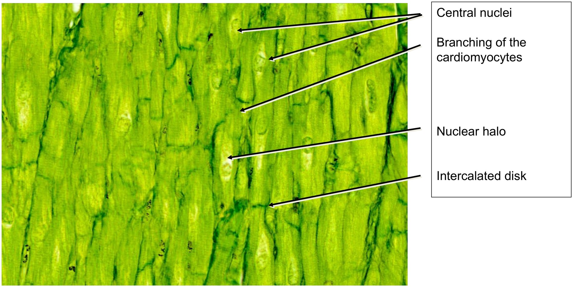 Intercalated discs (Heart muscle)