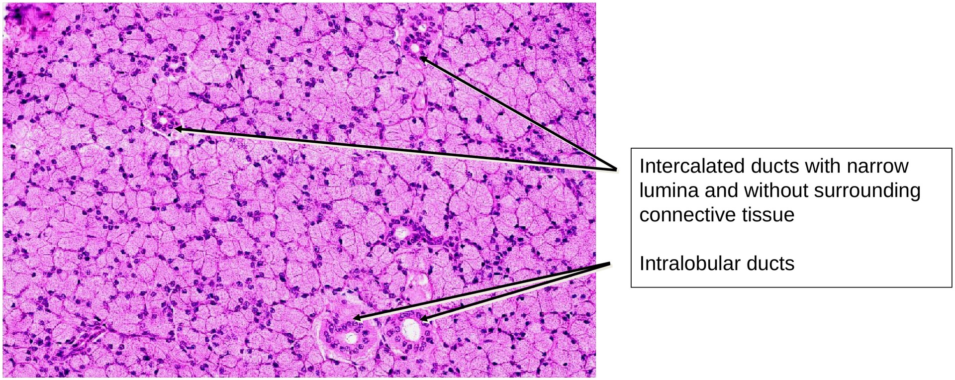 Parotid gland