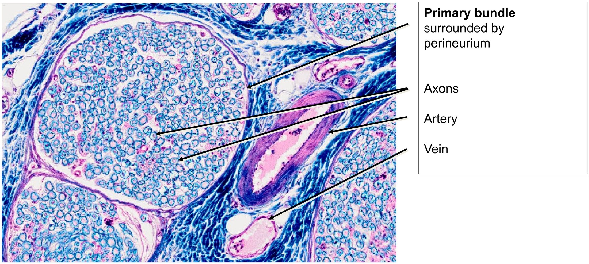 Peripheral nerve (sciatic nerve)