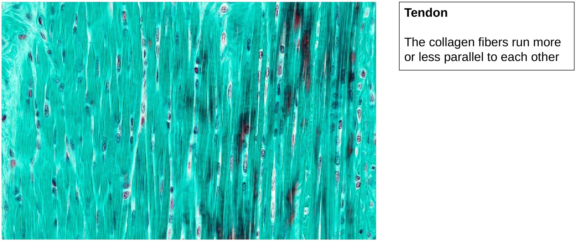 Ossification, perichondral (Finger)