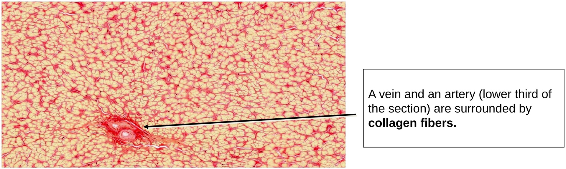 Elastic fibers (Nuchal ligament)