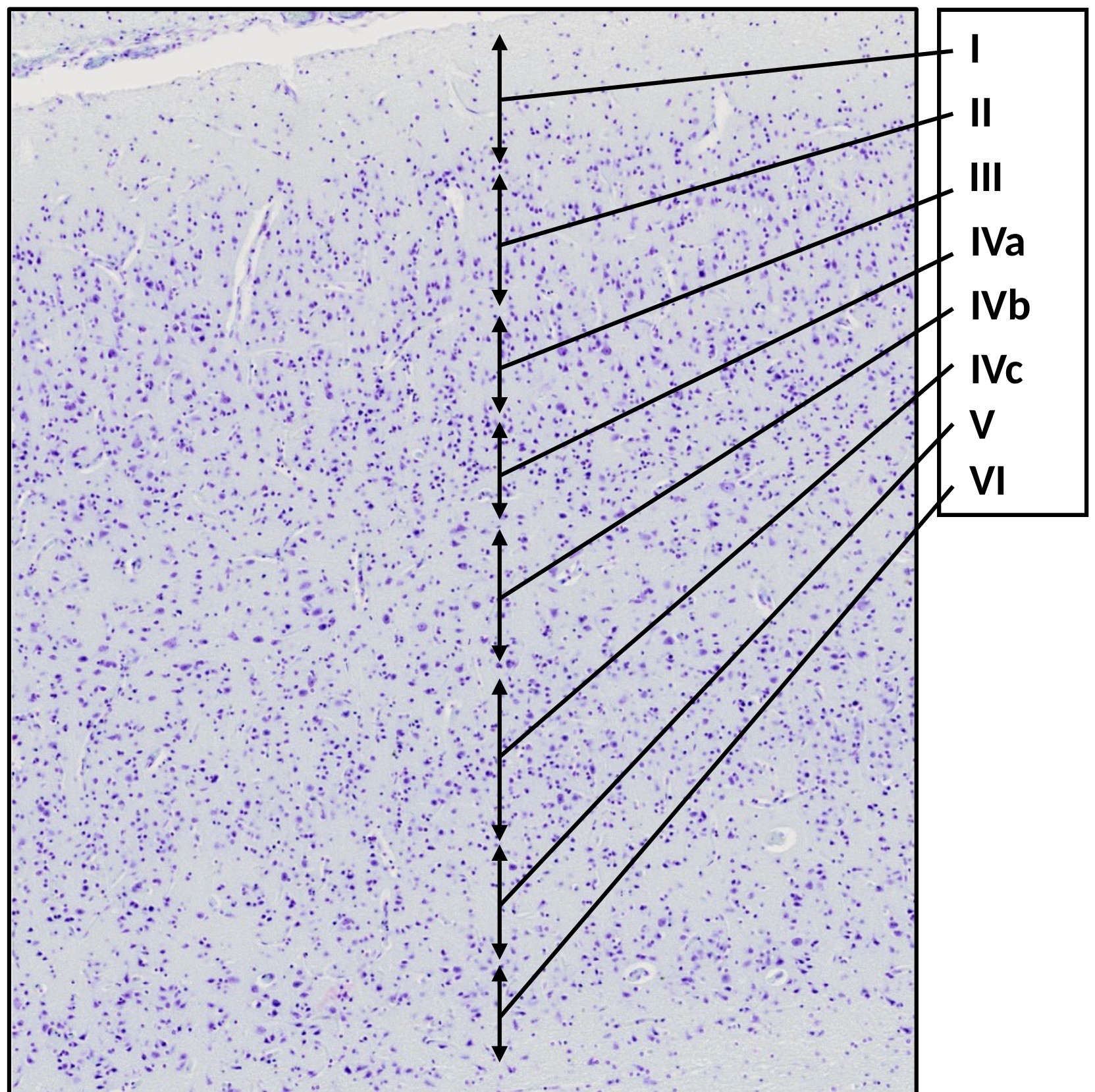 Cerebrum 3 (calcarine sulcus)