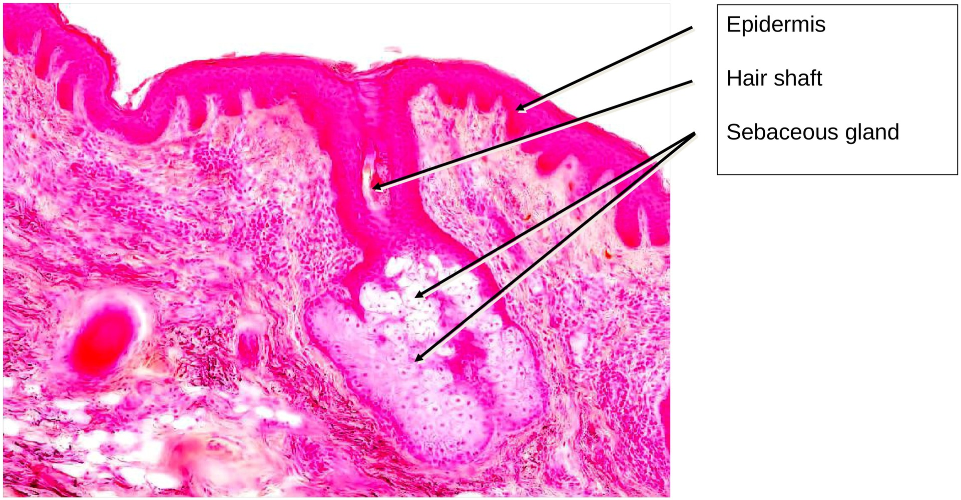 Elastic cartilage (Ear)