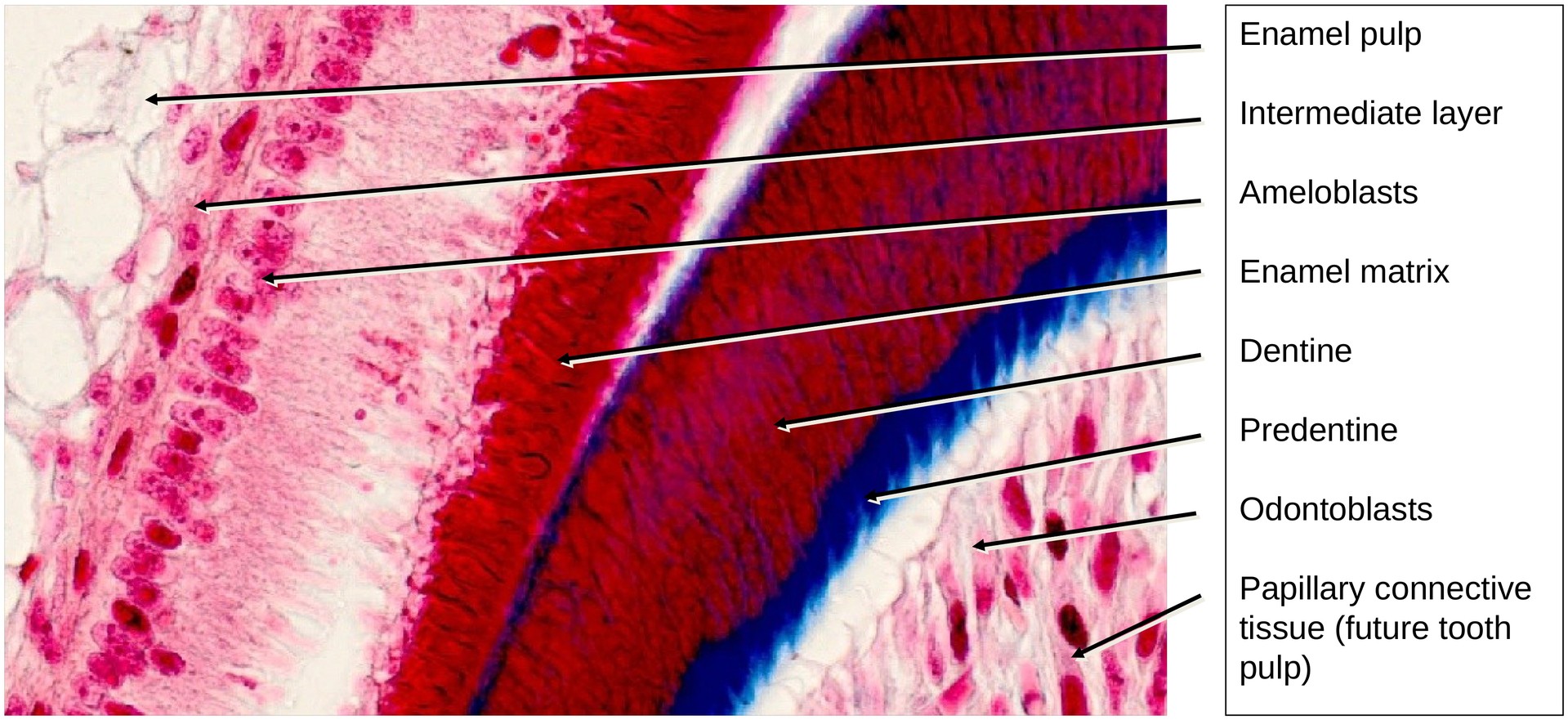 Tooth development II