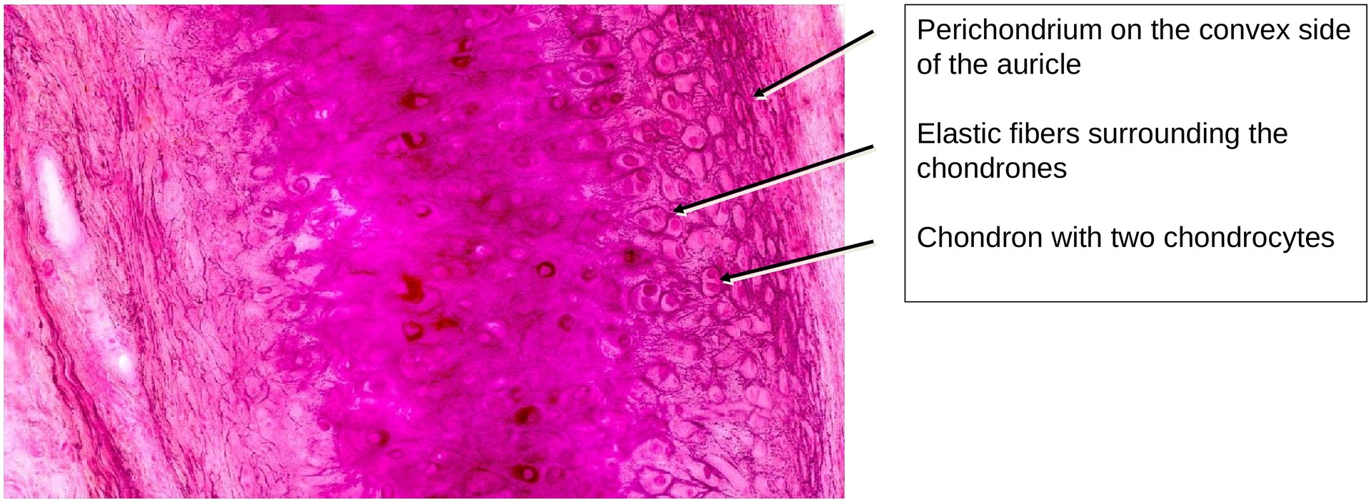 Elastic cartilage (Ear)
