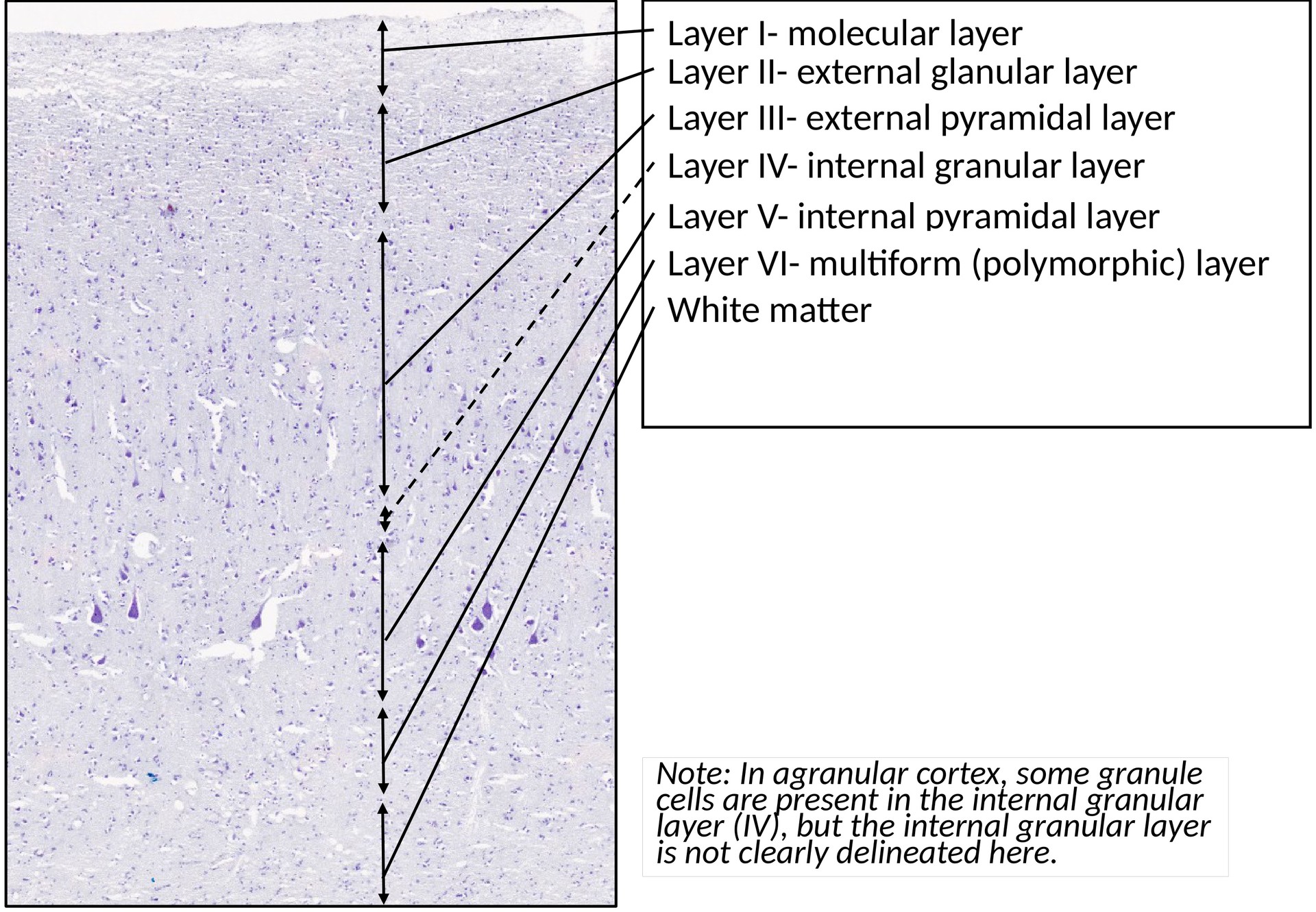 Cerebrum, area 1 (precentral gyrus)