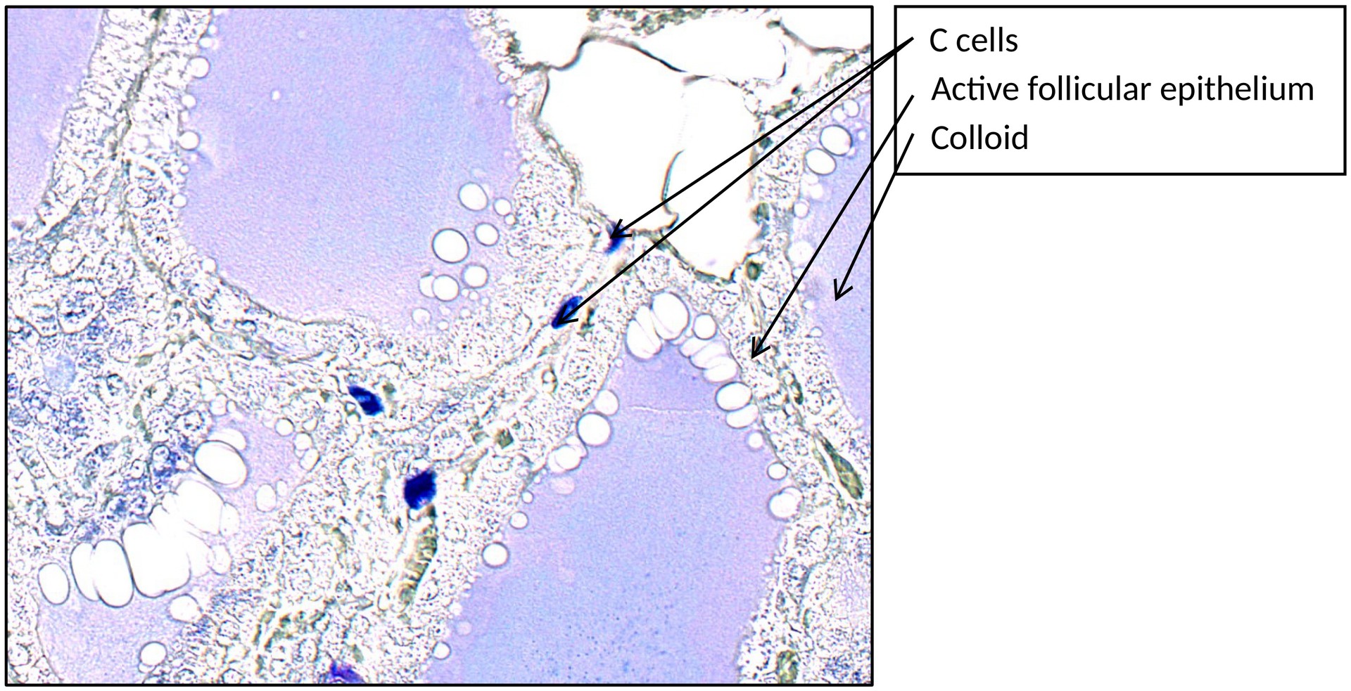 Thyroid gland C cells
