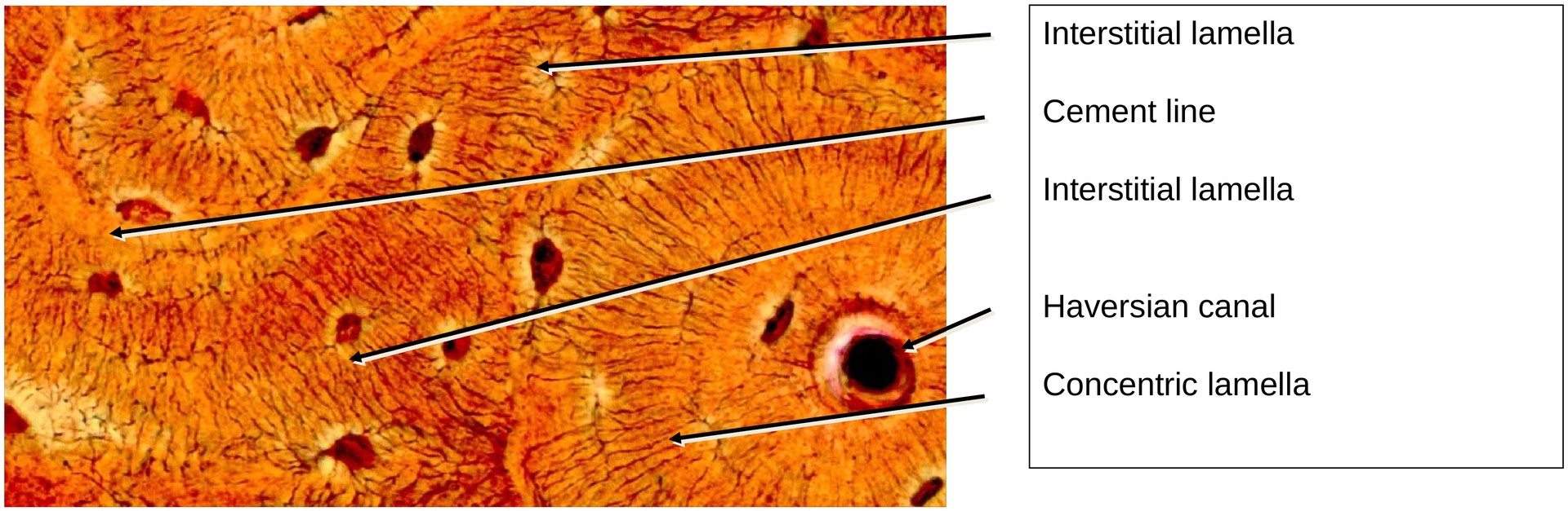 Lamellar bone (Dog, Tibia)