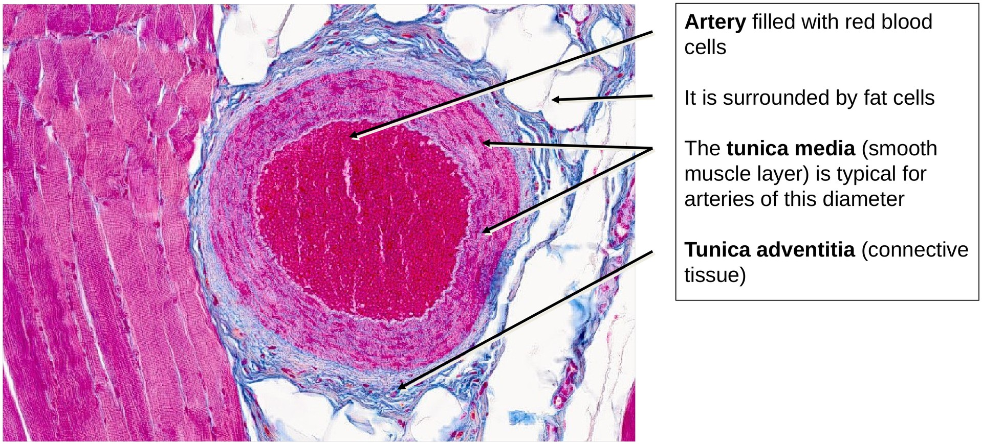 Skeletal muscle (longitudinal)