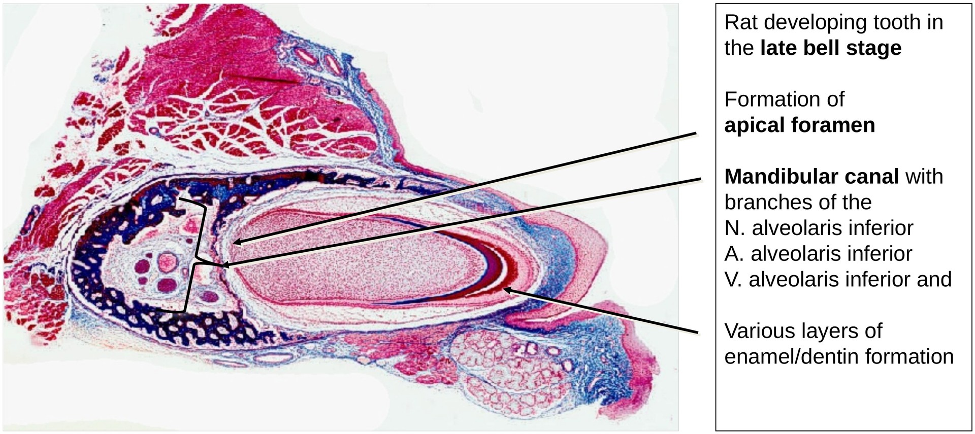 Tooth development II