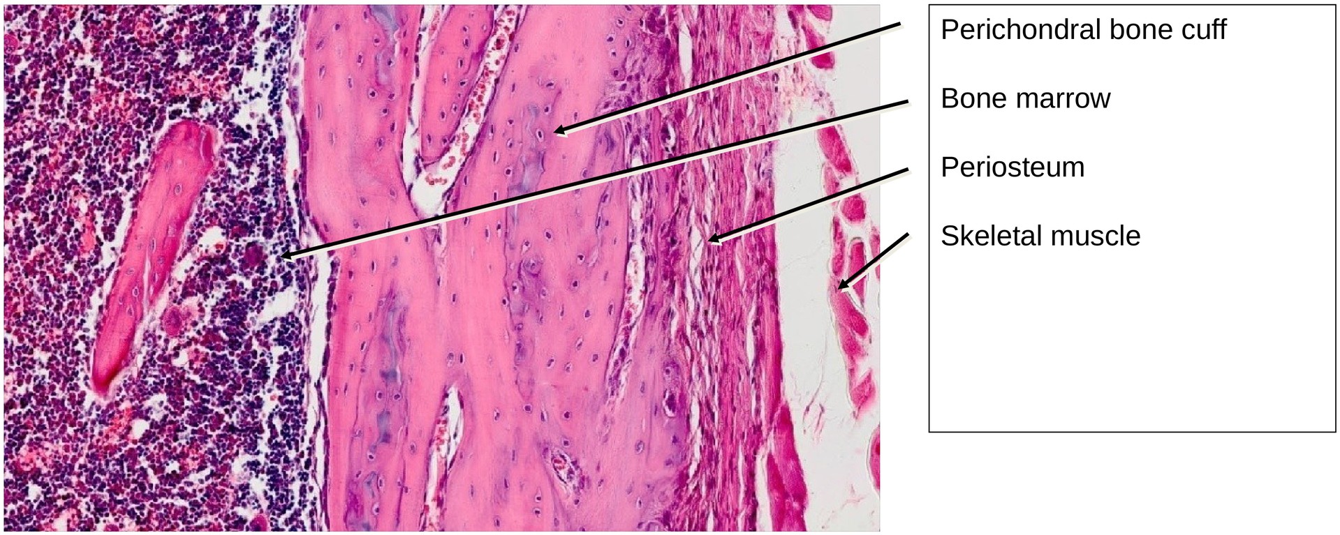 Ossification, endochondral