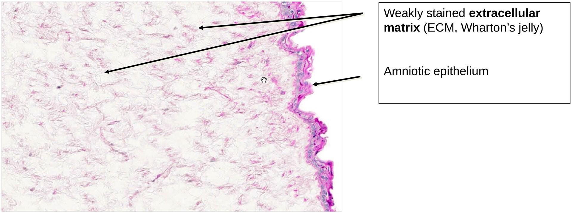 Fetal connective tissue (Umbilical Cord)