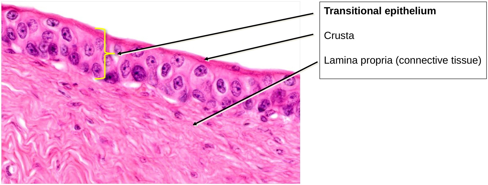 Transitional epithelium (urinary bladder)