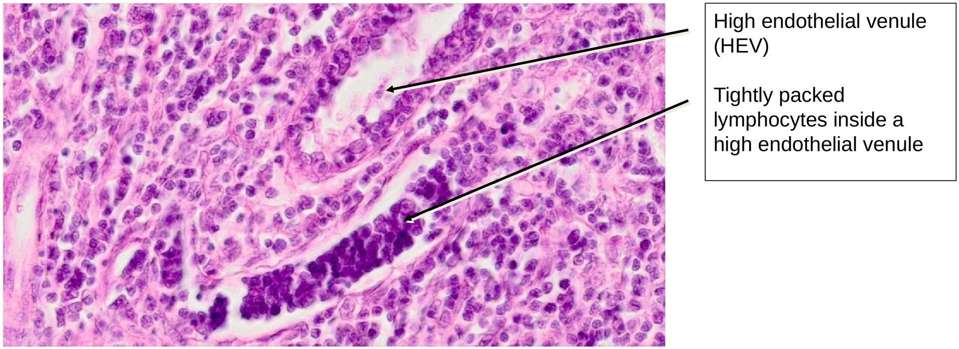 Ileum, Peyer’s patches