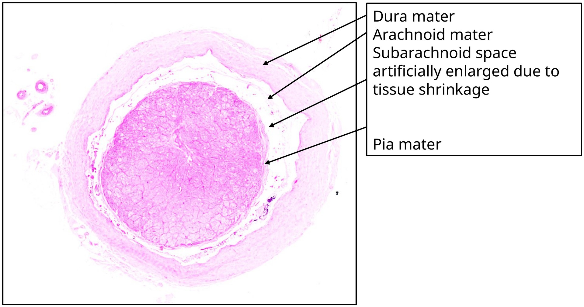 Optic nerve
