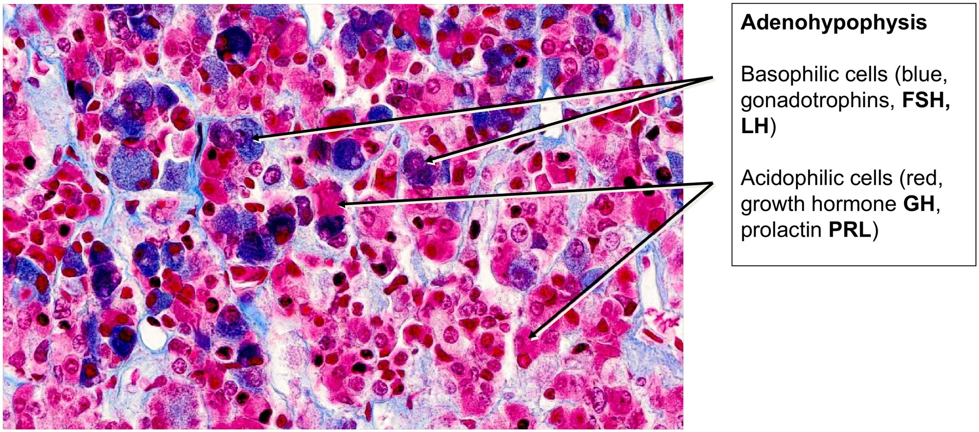 Pituitary gland (Hypophysis)