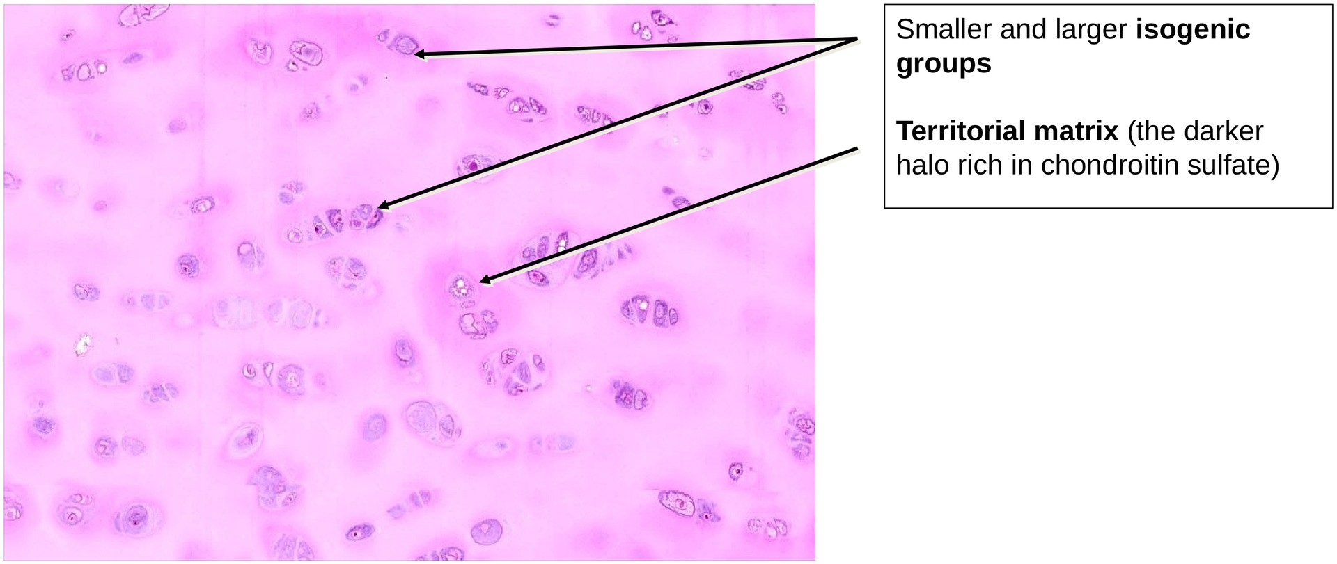 Hyaline cartilage (Rib)