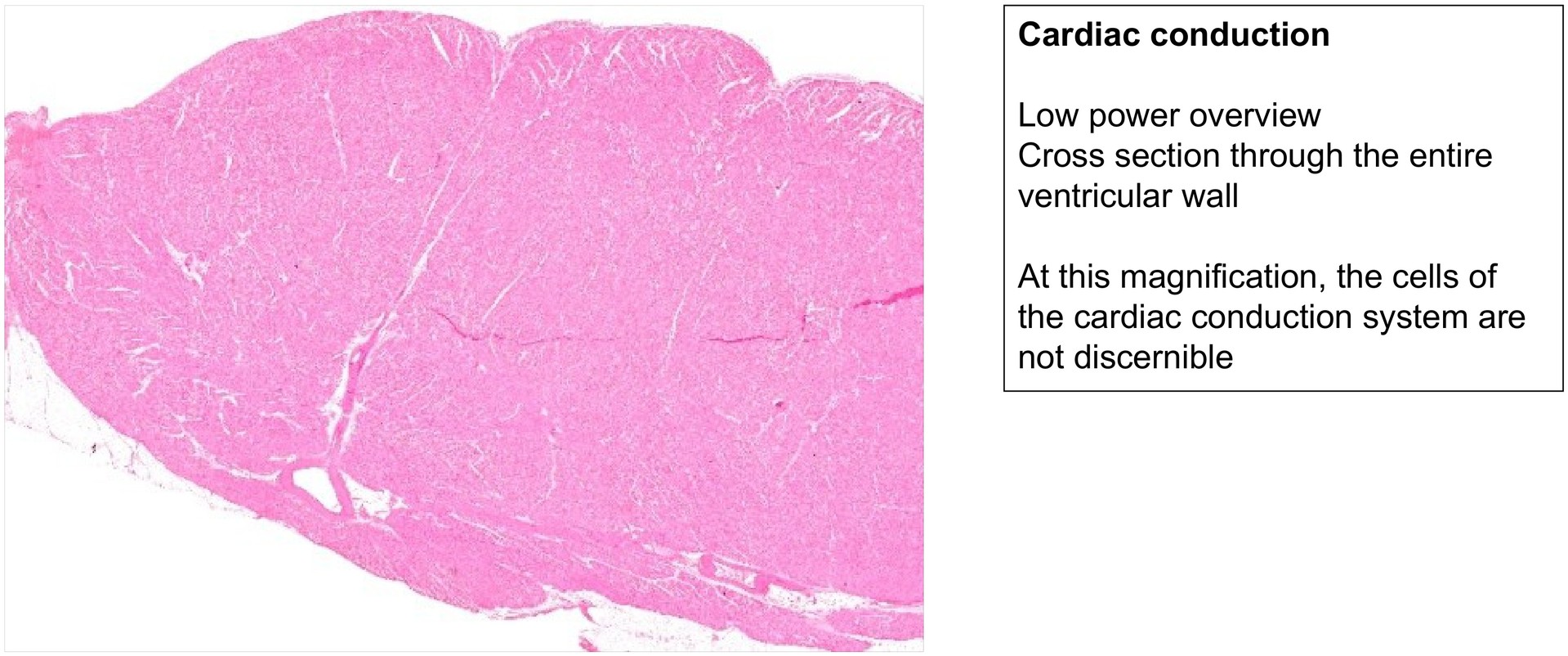 Cardiac conduction system