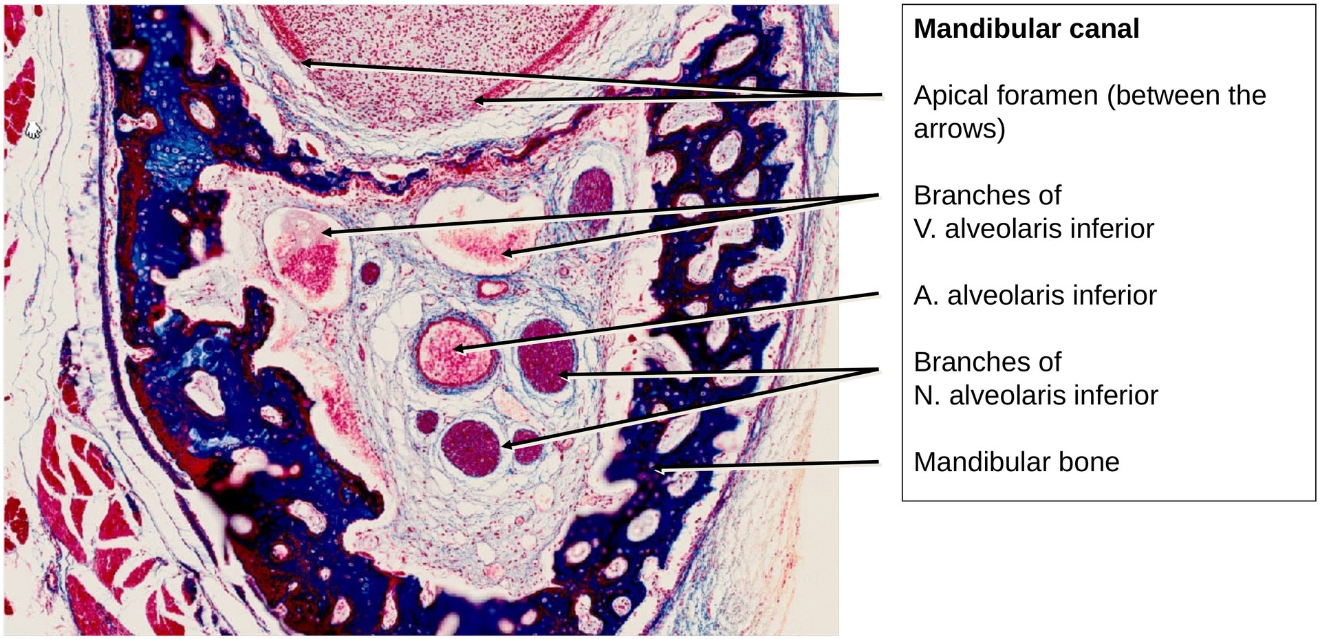 Tooth development II