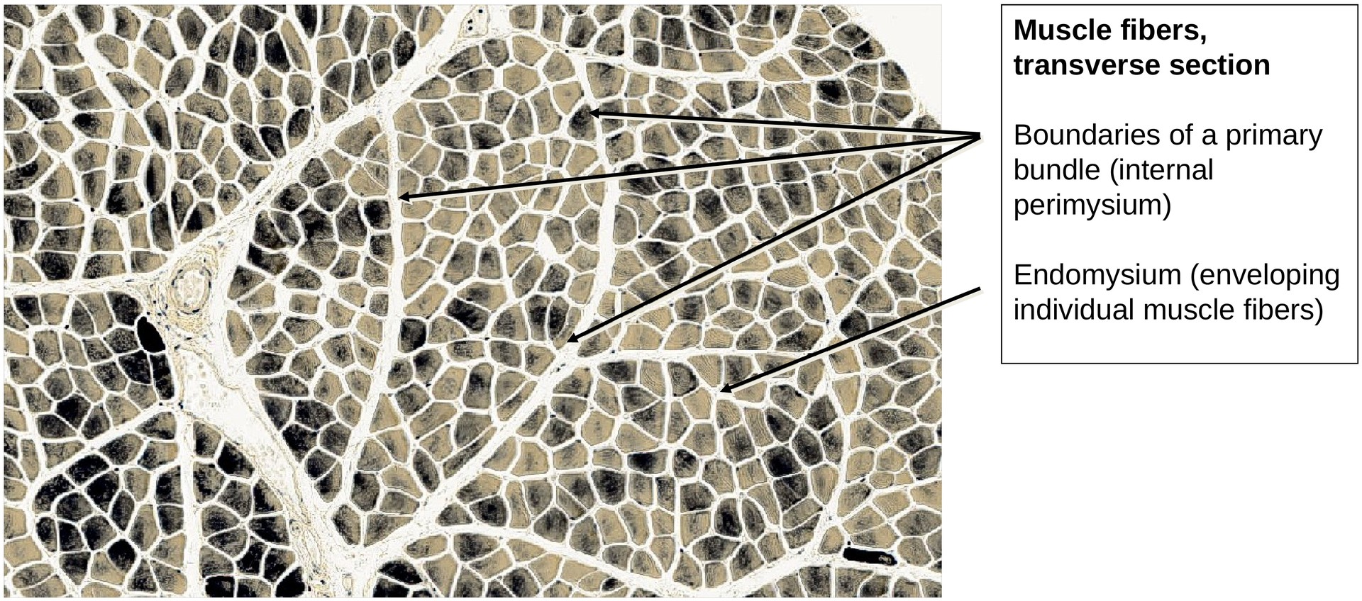 Skeletal muscle (transverse)