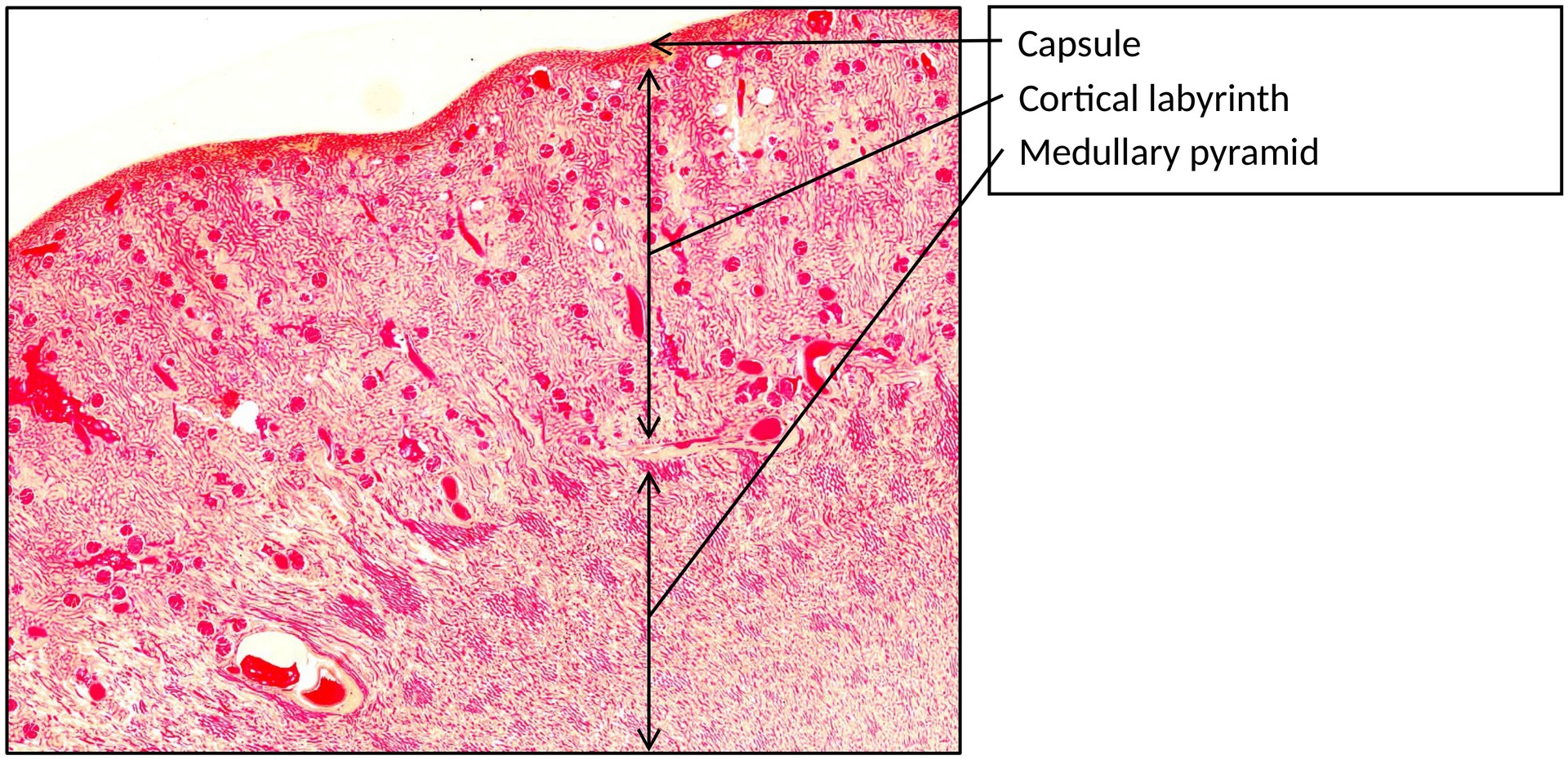 Kidney with ink injection