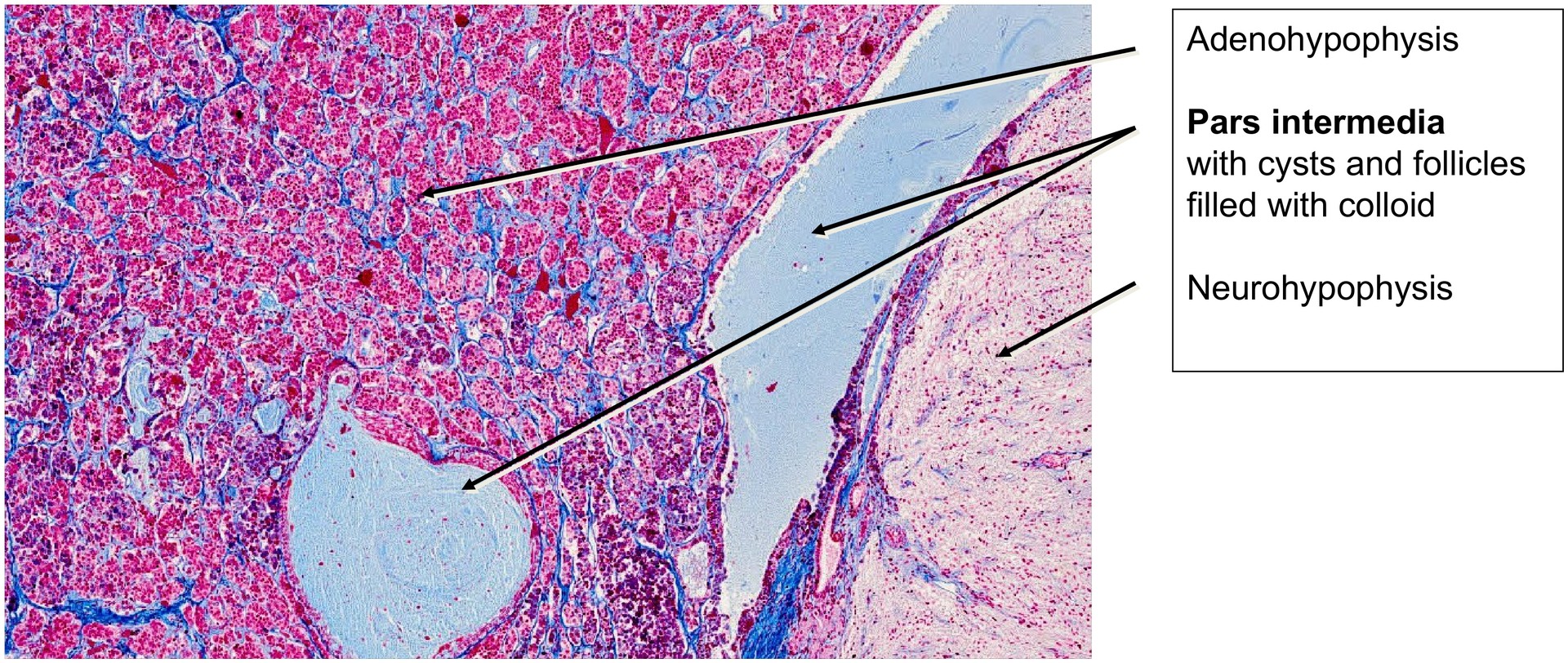 Pituitary gland (Hypophysis)
