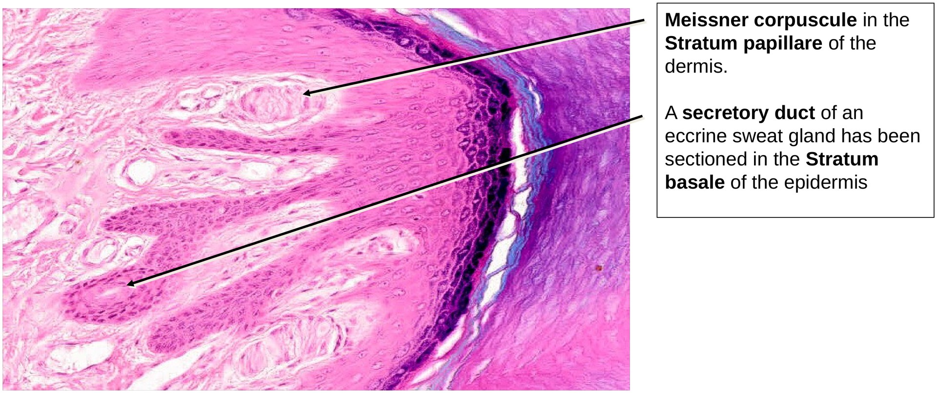 Keratinized stratified squamous epithelium (finger skin)
