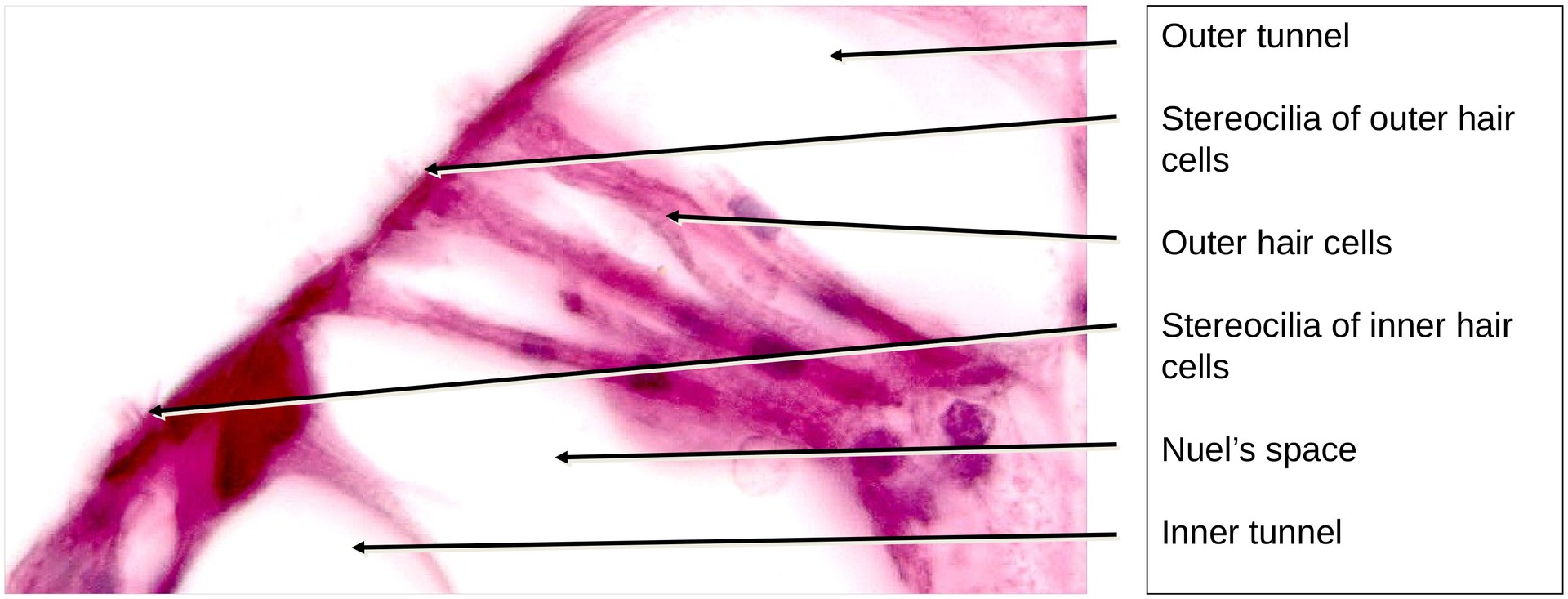 Inner ear, Organ of Corti