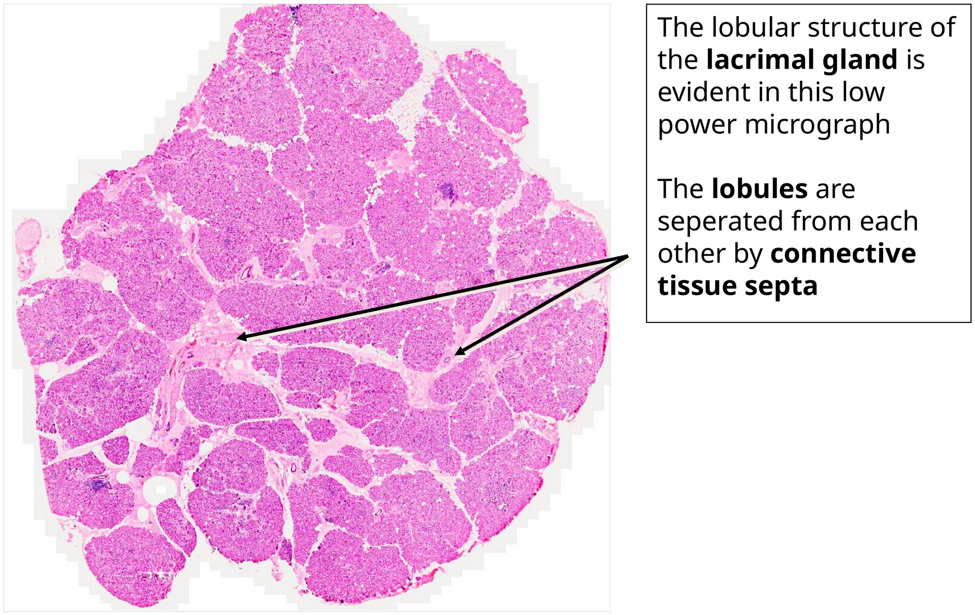 Lacrimal gland