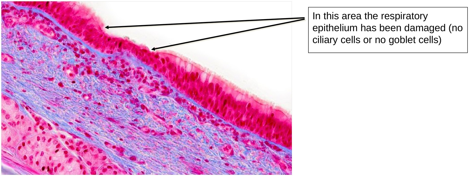 Respiratory epithelium (trachea)