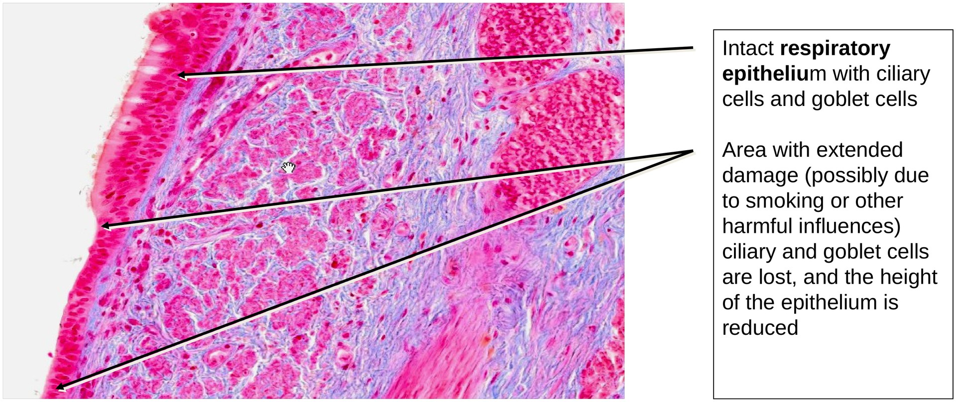 Respiratory epithelium (trachea)