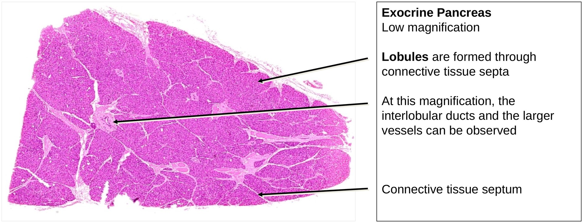 Pancreas, exocrine portion